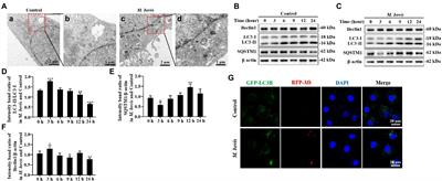 Mycoplasma bovis inhibits autophagy in bovine mammary epithelial cells via a PTEN/PI3K-Akt-mTOR-dependent pathway